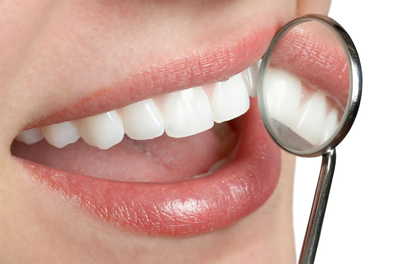 Avah Dental Dental Offer